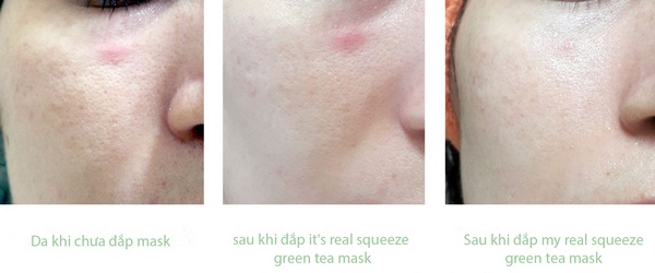 mặt nạ giấy innisfree my real squeeze mask review 