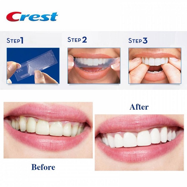 Công dụng Miếng Dán Trắng Răng Crest 3D White Strips Dental Whitening Kit